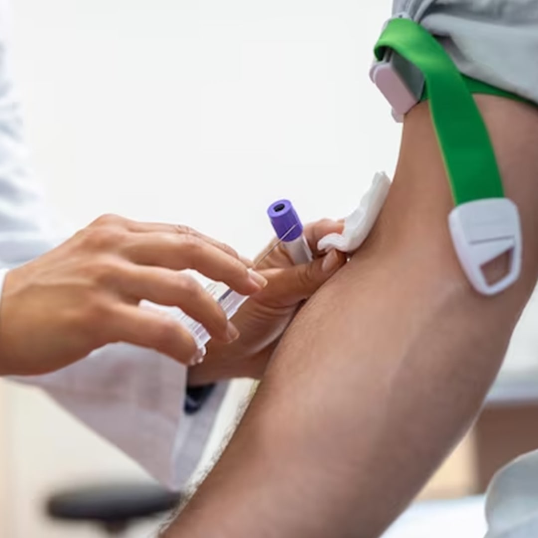 STI Screening